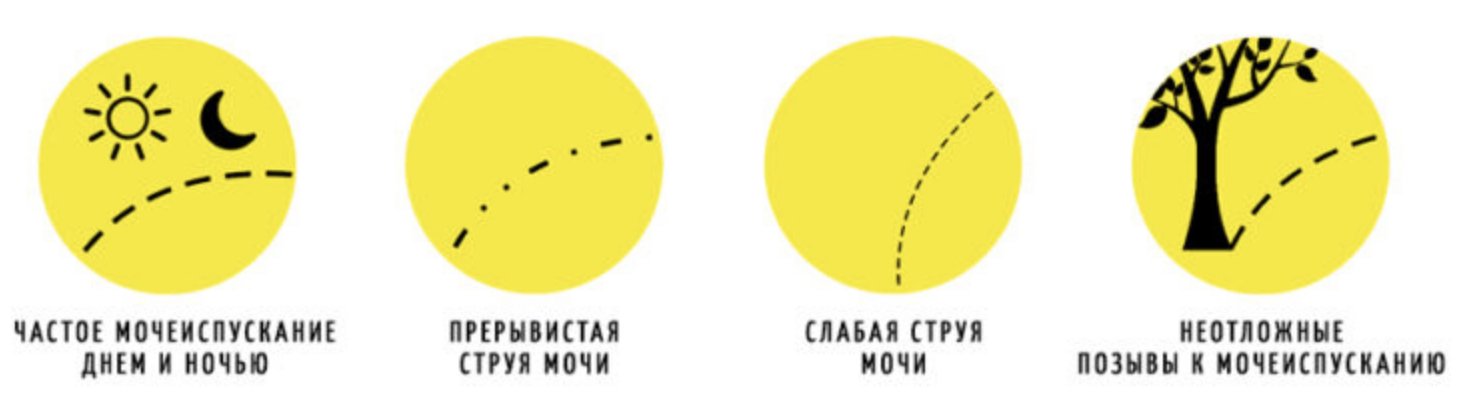 Слабая струя мочи: признак аденомы простаты?